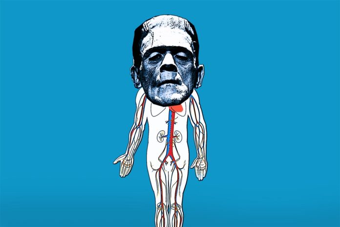 Frankenstein Scientist Attached a Head Transplant to a Dead Body Frankenstein Scientist Attached a Head Transplant to a Dead Body